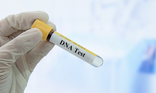 DNA Test Tube