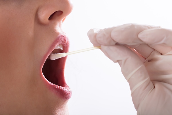 Mouth swab for DNA test
