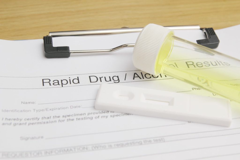 Know the Employment Drug Test Laws