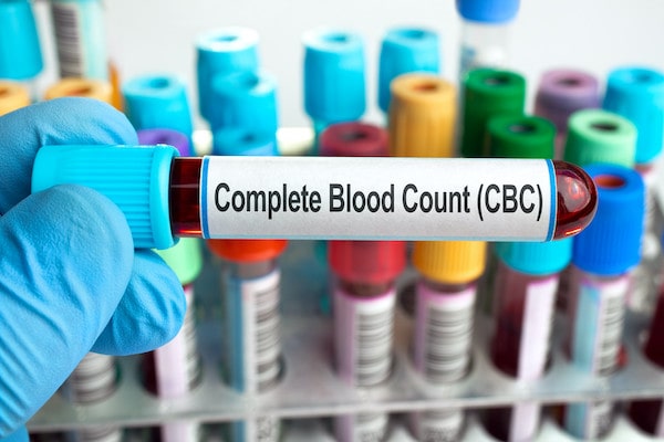 Complete Blood Count explained