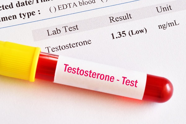 low testosterone test