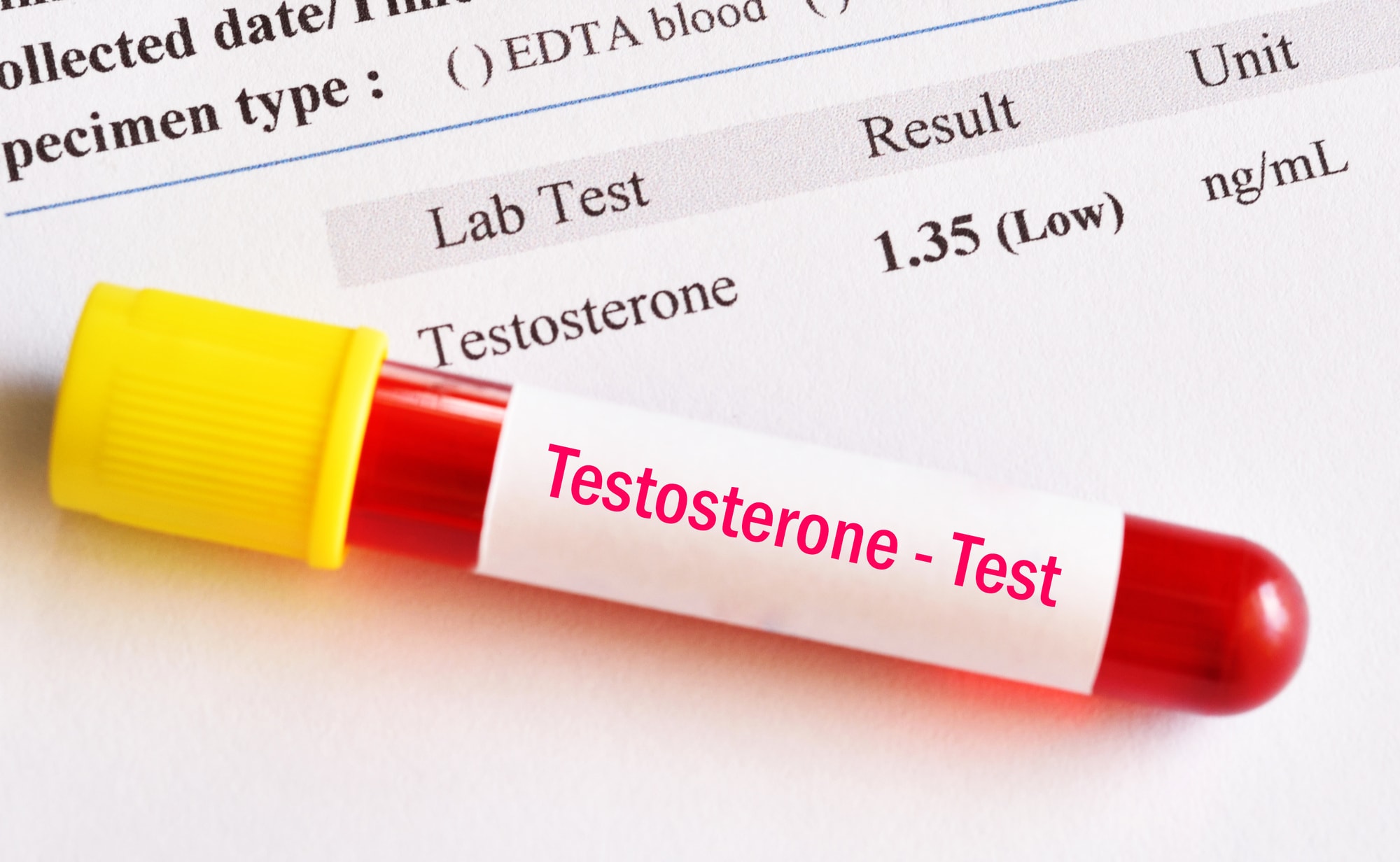 low testosterone test