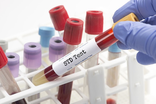 STD testing