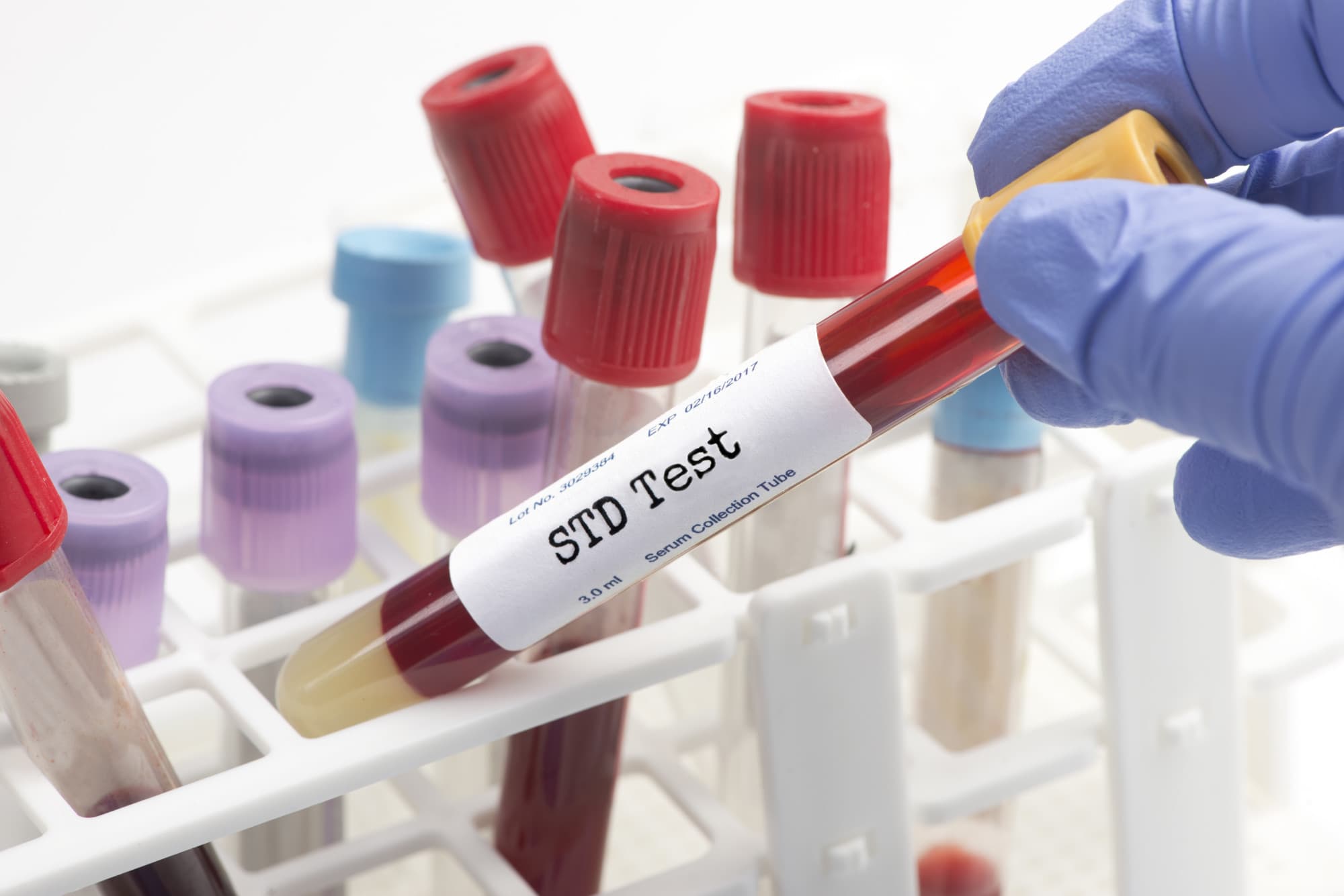 How Exactly Does STD Testing Work 