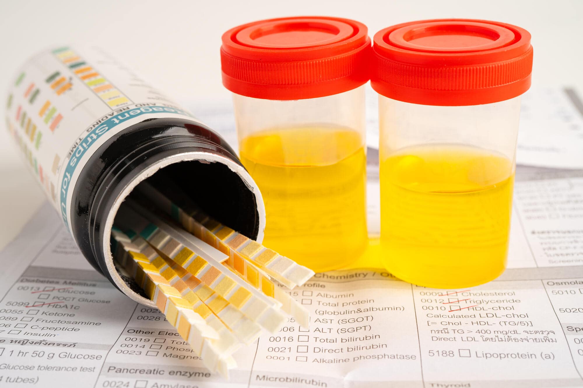 does acid show up on a urine drug test